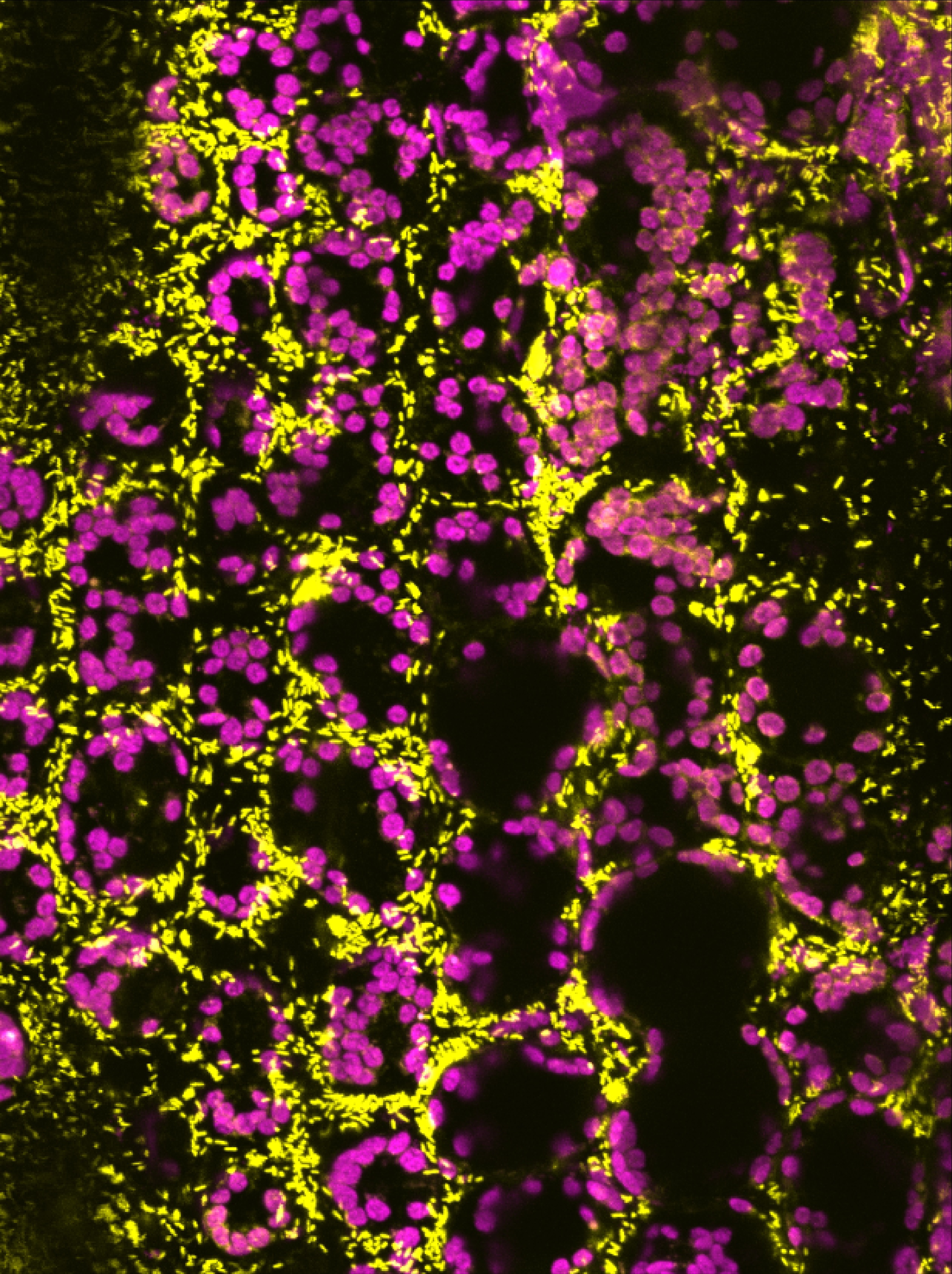 Uncovering the mechanisms of bacteria with toxic superpowers